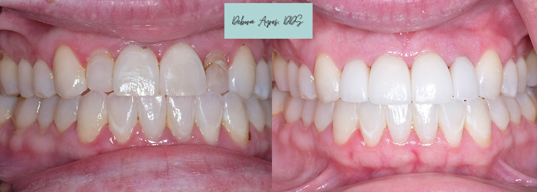 Dentist Bee Cave